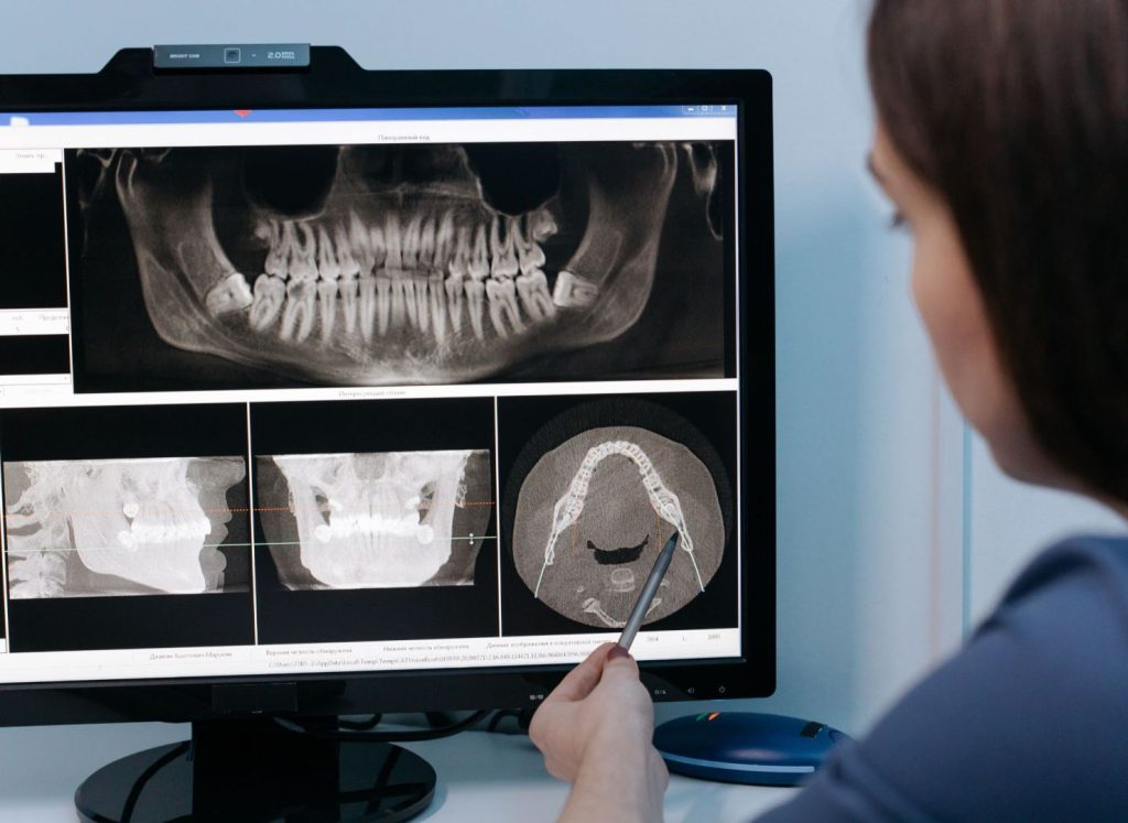 Aida Implantologia portale informativo | dentista implantologo