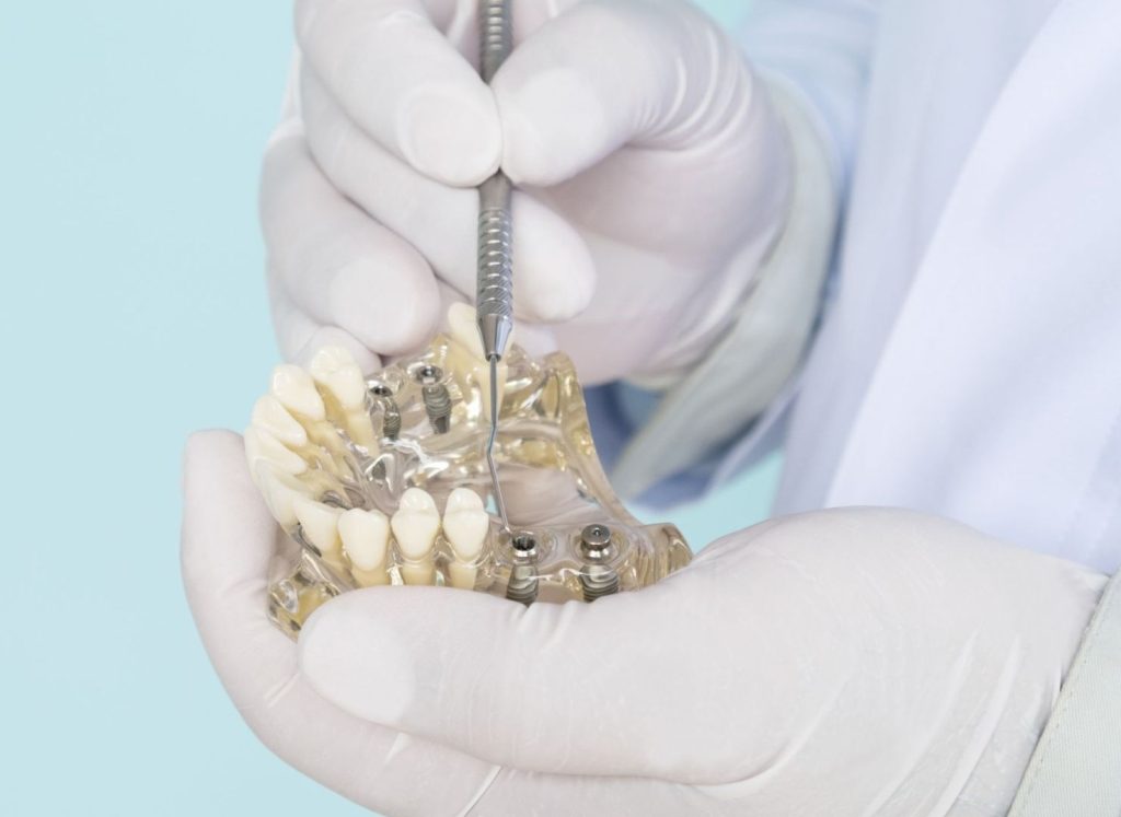 Aida Implantologia portale informativo | dentista implantologo