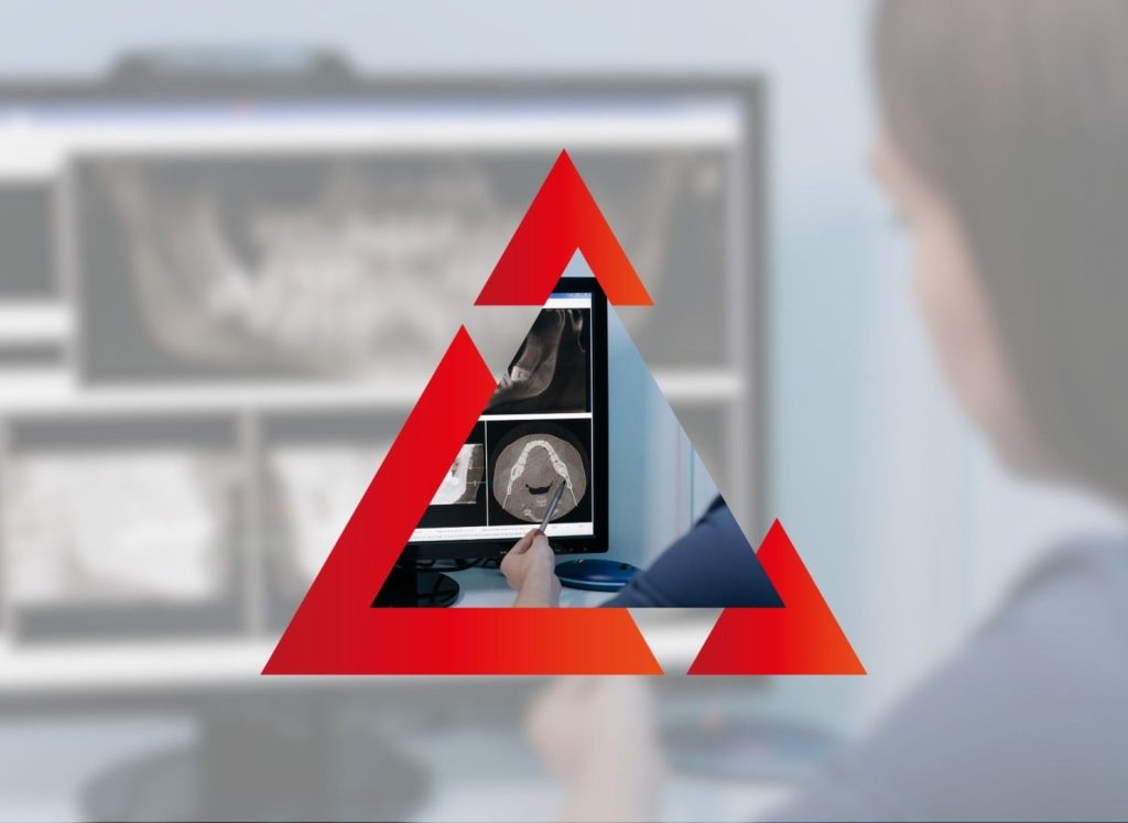 Implantologia Mini Invasiva La Tecnica Flapless 1