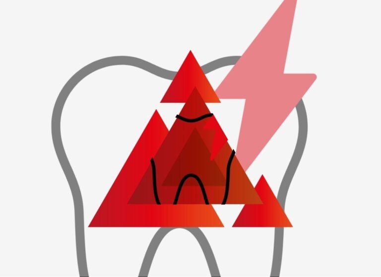 Implantologia a Carico Immediato