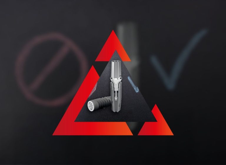 Implantologia a Carico Immediato_ Pro e Contro Impianto Dentale a Carico Immediato Pro e Contro