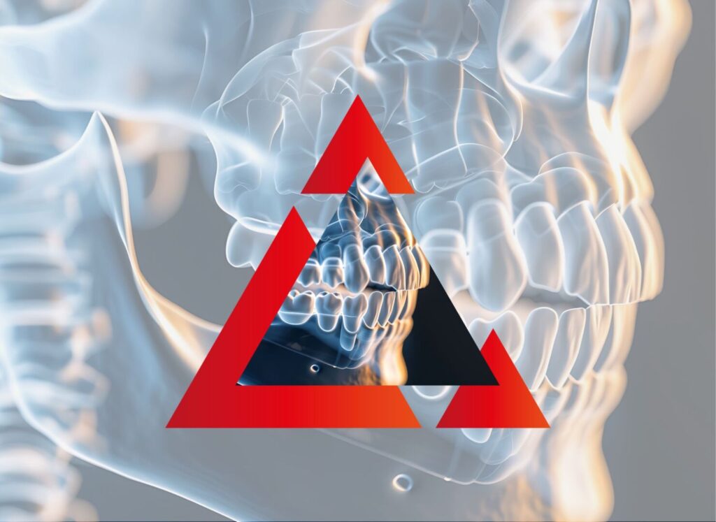 impianto dentale osteointegrato